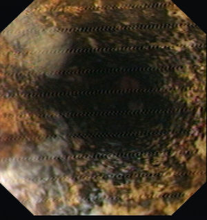 Figura 1