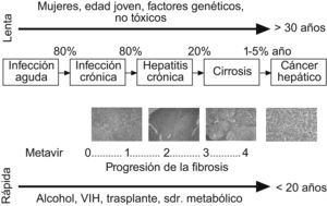 Historia natural de la fibrosis hepática y los factores que influyen en su progresión.