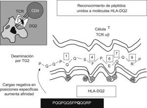 El gluten tiene un efecto doble sobre el intestino: algunos péptidos, como el fragmento p31–43 de la alfa-gliadina induce estrés de los enterocitos, que expresan IL15 y moléculas MICA, y activa a los linfocitos intraepiteliales para expresar el receptor NKG2D y activar la citotoxicidad contra la célula epitelial. El paso de péptidos inmunogénicos a la lámina propia estimula a linfocitos T CD4+ específicos cuando se presentan junto a moléculas HLA-DQ2/DQ8, tras tener una modificación por parte de la transglutaminasa tisular (TGt o TG2). Se activan respuestas de citocinas proinflamatorias y mecanismos causantes de la transformación mucosa.