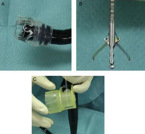 Partes del sistema OVESCO: A) capuchón con clip premontado sobre el endoscopio. B) Pinzas para aproximación de los bordes de la perforación. C) Carrete sobre canal de trabajo que permite la liberación del clip.