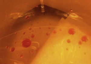 Muestras de “orange oily anal leakage”.