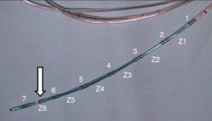 Extremo distal de una sonda de impedanciometría intraluminal esofágica con distancia de 2cm entre cada uno de los 7 sensores (numerados del 1 al 7) que definen los 6 canales de estudio (rotulados Z1 a Z6). Entre el último y el penúltimo sensor de impedancia se sitúa el de pH (flecha blanca).