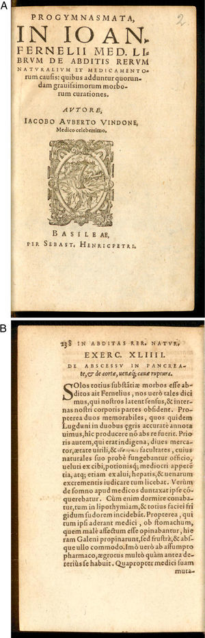 A y B. Libro publicado por Iacobo Auberto Vindone en 1579 en el que describe por primera vez la clínica y los hallazgos de la autopsia de una necrosis pancreática en un paciente alcohólico.