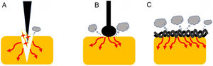 Endoscopic devices with different designs. Needle-tipped knives (A) keep electrical current strongly focused in a targeted tissue increasing current density and promoting the cutting effect. Ball-tipped knifes and braided snares (B and C, respectively) increase its contact with the surface area that lead to lower current density and induces higher coagulation effect.