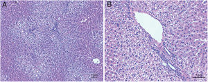 Hematoxylin and eosin staining results in steatosis group. The typical picture of hematoxylin and eosin (H&E) staining from five independent experiments in steatosis group (A, 100× magnification; B, 200× magnification). Special diet for 4 weeks induced severe fat deposition and mild inflammation in steatosis group.