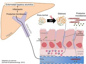 Efecto del microbioma en la enfermedad hepática alcohólica. OH: etanol.