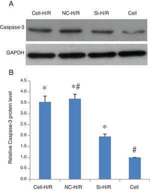 Caspase-3 protein expression was induced by H/R and suppressed by transfection of frizzled-2 siRNA. (A) Representative photographs of protein expression of Caspase-3 and GAPDH; (B) relative Caspase-3 protein level was normalized to GAPDH; data were presented as means±SEM from three independent experiments. *p<0.05 when comparing to Cell group, and #p<0.05 when comparing to Si-H/R group.