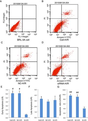 Transfection of frizzled-2 siRNA inhibited the H/R induced apoptosis in BRL-3A cells by Flow Cytometry using Annexin-V-FITC method. (A) BRL-3A cells alone; (B) BRL-3A cells with H/R treatment (Cell-H/R); (C) H/R treatment of BRL-3A cells with transfection of negative control siRNA (NC-H/R); (D) H/R treatment of BRL-3A cells with transfection of frizzled-2 siRNA (Si-H/R); (E) quantitative analysis of the early cell apoptosis; (F) quantitative analysis of the late cell apoptosis; (G) quantitative analysis of the early cell apoptosis. Data were presented as means±SEM from three independent experiments. *p<0.05 and **p<0.001 when comparing to Cell group, and #p<0.05 and ##p<0.001 when comparing to Si-H/R group.
