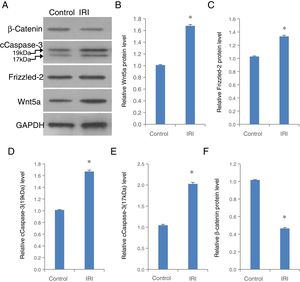 The up-regulation of Wnt5a, Frizzled-2, cleaved Caspase-3 (cCaspase-3) accompanied by a decrease in β-catenin was shown in liver tissues from mice with IRI. (A) Representative photographs of protein expression of Frizzled-2, Wnt5a, cCaspase-3 (17kDa and 19kDa), β-catenin and GAPDH; (B) relative protein level of Wnt5a; (C) relative protein level of Frizzled-2; (D) relative cCaspase-3 (19kDa); (E) relative cCaspase-3 (17kDa); (F) relative β-catenin gene expression. Bar graphs showing the relative protein expression of Wnt5a, Frizzled-2, cCaspase-3 (17kDa and 19kDa) and β-catenin were individually normalized to GAPDH and presented as means±SEM from six mice from group IRI or control group with sham operations. *p<0.05 when comparing to control group.