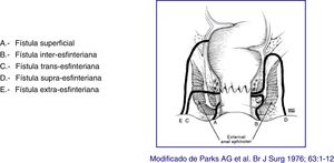 Clasificación de Parks de las fístulas.