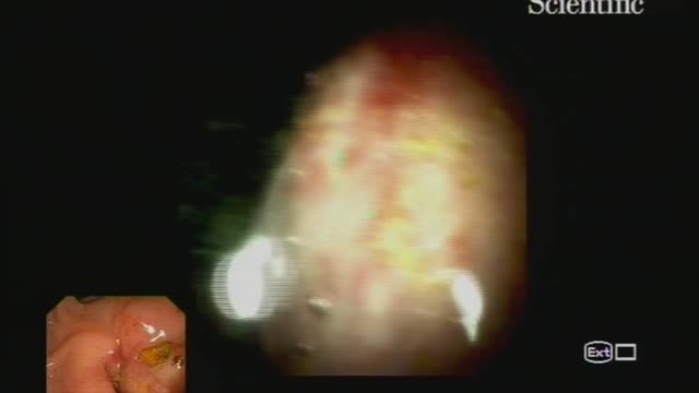 https://ars.els-cdn.com/content/image/1-s2.0-S0210570520300182-mmc1.mp4