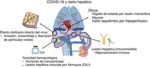 Fisiopatología de la lesión hepática: diversos mecanismos en relación con la infección por SARS-CoV2 pueden inducir alteraciones hepáticas, tanto directamente por el efecto citopático del virus, como por el efecto indirecto de la hiperactivación inmunológica o la toxicidad farmacológica.
