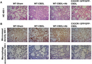 The effects of CX3CR1 blockade on the pathological changes of the lungs, angiogenesis, and macrophage accumulation. A. H&E staining of lung tissues at 100× and 400× magnification in the WT-sham, WT-CBDL, WT-CBDL+Ab, and CX3CR1GFP/GFP groups. B. Immunohistochemical staining for intrapulmonary angiogenesis using the CD31 antibody in the groups and immunohistochemical staining for macrophage accumulation in the lungs using the CD68 antibody in four groups.