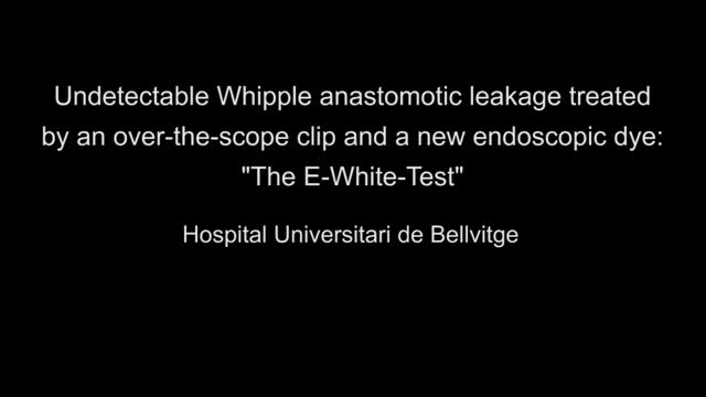 https://ars.els-cdn.com/content/image/1-s2.0-S0210570522000024-mmc1.mp4