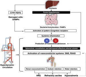 Pathophysiology of refractory ascites in cirrhosis.