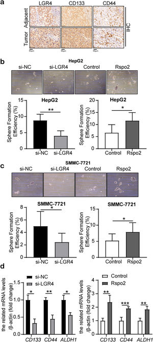 LGR4 promotes cancer stem cell-like properties of HCC cells. (a) Representative immunohistochemical staining of CD133 and CD44 in human HCC tissues and adjacent tissues. (b, c) Sphere formation assay of HepG2 (b) and SMMC-7721 (c) cells treated with exogenous Rspo2 (100ng/mL) or si-LGR4 (scale bar: 200μm). Control used PBS or scramble siRNA (si-NC). (d) Quantitative real-time PCR analysis of CD133, CD44 and ALDH1 expression in HepG2 cells treated with exogenous Rspo2 (100ng/mL) or si-LGR4. Control used PBS or scramble siRNA (si-NC). At least three independently repeated experiments were conducted. Data was expressed as mean±SD and analyzed by two-tailed Student's t-test. *P<0.05, **P<0.01, ***P<0.001. LGR4, the leucine-rich repeat-containing G-protein-coupled receptor 4; HCC, hepatocellular carcinoma; Rspo2, R-spondin2; PBS, phosphate buffer saline; ALDH1, aldehyde dehydrogenase 1; SD, standard deviation.