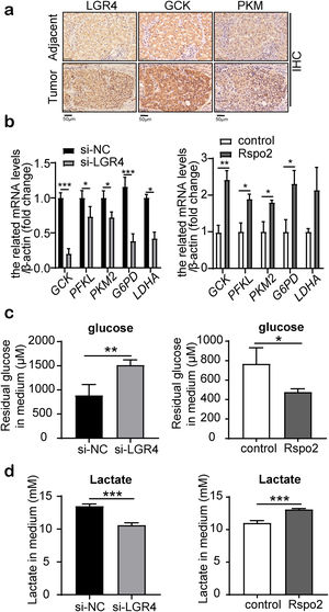 LGR4 promotes the Warburg effect of HCC cells. (a) Representative immnunohistochemical staining of GCK and PKM in human HCC tissues and adjacent tissues. (b) Quantitative real-time PCR analysis of GCK, PFKL, PKM2, G6PD and LDHA expression in HepG2 cells treated with exogenous Rspo2 (100ng/mL) or si-LGR4. Control used PBS or scramble siRNA (si-NC). (c, d) Glucose (c) and lactate (d) concentration in the supernatant of cultured HepG2 cells treated with exogenous Rspo2 (100ng/mL) or si-LGR4. Control used PBS or scramble siRNA (si-NC). At least three independently repeated experiments were conducted. Data was expressed as mean±SD and analyzed by two-tailed Student's t-test. *P<0.05, **P<0.01, ***P<0.001. LGR4, the leucine-rich repeat-containing G-protein-coupled receptor 4; HCC, hepatocellular carcinoma; GCK, glucose kinase; PKM, pyruvate kinase M; PFKL, phosphofructokinase; G6PD, glucose 6-phosphate dehydrogenase; LDHA, lactate dehydrogenase A; Rspo2, R-spondin2; PBS, phosphate buffer saline; SD, standard deviation.