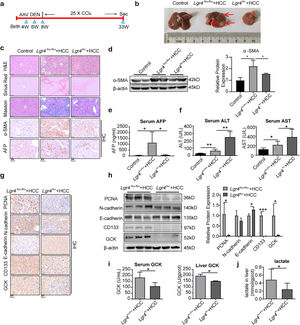 LGR4 promotes the HCC formation in mice. (a) Protocol on HCC model induced by DEN combined with CCl4. (b) Representative images of livers from each group of mice. Mice were randomly assigned to the control, Lgr4flox/flox+HCC, and Lgr4lko+HCC groups (n=6–8). (c) Representative images of H&E, Sirius Red staining, Masson staining, immunohistochemical staining of α-SMA and AFP of livers from each group of mice. (d) Western blotting analysis of α-SMA in liver tissues from each group of mice. (e) Determination of serum AFP in each group of mice. (f) Measurement of ALT and AST in the serum of each group of mice. (g) Representative images of immunohistochemical staining of PCNA, N-cadherin, E-cadherin, CD133 and GCK in livers of each group of mice. (h) Representative Western blotting of PCNA, N-cadherin, E-cadherin, CD133 and GCK in liver tissues from each group of mice. (i) GCK enzyme activity in serum and liver of each group of mice. (j) Lactate concentration in liver tissues. At least three independently repeated experiments were conducted. Data was expressed as mean±SD. Significance tested using: One-Way ANOVA (d–f), and two-tailed Student's t-test (h–j). * P<0.05, **P<0.01. LGR4, the leucine-rich repeat-containing G-protein-coupled receptor 4; HCC, hepatocellular carcinoma; DEN, diethylnitrosamine; CCl4, carbon tetrachloride; α-SMA, alpha smooth muscle actin; AFP, alpha-fetoprotein; ALT, alanine aminotransferase; AST, aspartate aminotransferase; PCNA, proliferating cell nuclear antigen; GCK, glucose kinase; ANOVA, analysis of variance; SD, standard deviation.