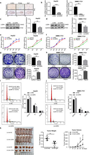 LGR4 promotes HCC cell proliferation. (a) Immunoreactivity of PCNA and Ki67 in human HCC tissues and adjacent tissues. (b–d) Quantitative real-time PCR and Western blotting analysis of LGR4 in HepG2 and SMMC-7721 cells treated with si-LGR4 or si-NC. (e–h) CCK-8 assays (e, f) and plate colony formation assays (g, h) in HepG2 and SMMC-7721 cells treated with exogenous Rspo2 (100ng/mL) or si-LGR4. Control used PBS or scramble siRNA (si-NC). (i, j) Cell cycle analysis of HepG2 (i) and SMMC-7721 (j) cells treated with si-LGR4 or si-NC. (k) Subcutaneous xenograft tumor of HepG2 cells with stable silencing of LGR4, and the weight and volume of xenografts (n=6 mice per group). At least three independently repeated experiments were conducted. Data was expressed as mean±SD and analyzed by two-tailed Student