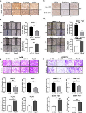 LGR4 promotes migration, invasion and EMT of HCC cells. (a) Representative immunohistochemical staining of E-cadherin, N-cadherin and MMP9 in human HCC tissues and adjacent tissues. (b) Representative immunohistochemical staining of E-cadherin and N-cadherin in LV-sh-NC and LV-sh-LGR4 group of xenograft tumor model. (c, d) Wound healing assay on HepG2 (c) and SMMC-7721 (d) cells treated with exogenous Rspo2 (100ng/mL) or si-LGR4. Control used PBS or scramble siRNA (si-NC). (e, f) Transwell assays on HepG2 (e) and SMMC-7721 (f) cells treated with exogenous Rspo2 (100ng/mL) or si-LGR4 with (lower panel) or without (upper panel) matrigel, scale bar: 200μm. At least three independently repeated experiments were conducted. Data was expressed as mean±SD and analyzed by two-tailed Student