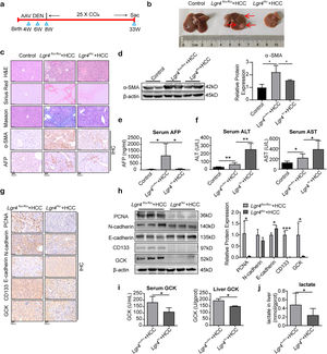 LGR4 promotes the HCC formation in mice. (a) Protocol on HCC model induced by DEN combined with CCl4. (b) Representative images of livers from each group of mice. Mice were randomly assigned to the control, Lgr4flox/flox+HCC, and Lgr4lko+HCC groups (n=6–8). (c) Representative images of H&E, Sirius Red staining, Masson staining, immunohistochemical staining of α-SMA and AFP of livers from each group of mice. (d) Western blotting analysis of α-SMA in liver tissues from each group of mice. (e) Determination of serum AFP in each group of mice. (f) Measurement of ALT and AST in the serum of each group of mice. (g) Representative images of immunohistochemical staining of PCNA, N-cadherin, E-cadherin, CD133 and GCK in livers of each group of mice. (h) Representative Western blotting of PCNA, N-cadherin, E-cadherin, CD133 and GCK in liver tissues from each group of mice. (i) GCK enzyme activity in serum and liver of each group of mice. (j) Lactate concentration in liver tissues. At least three independently repeated experiments were conducted. Data was expressed as mean±SD. Significance tested using: One-Way ANOVA (d–f), and two-tailed Student