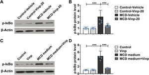 Treatment of Vinpocetine reduced the activation of NFκB signaling both in vivo and in vitro. Mice were exposed to MCD or chow diet with the treatment of Vinpocetine (20mg/kg) or vehicle for 8 weeks. (A, B) The protein expression levels of p-IκBα in the liver were detected by Western blot (n=7 mice per group). Primary hepatocytes from mice were cultured and exposed to the MCD medium with the treatment of Vinpocetineocetine (50μM) or vehicle for 24h. (C, D) The protein expression levels of p-IκBα were detected by Western blot (n=4 per group).