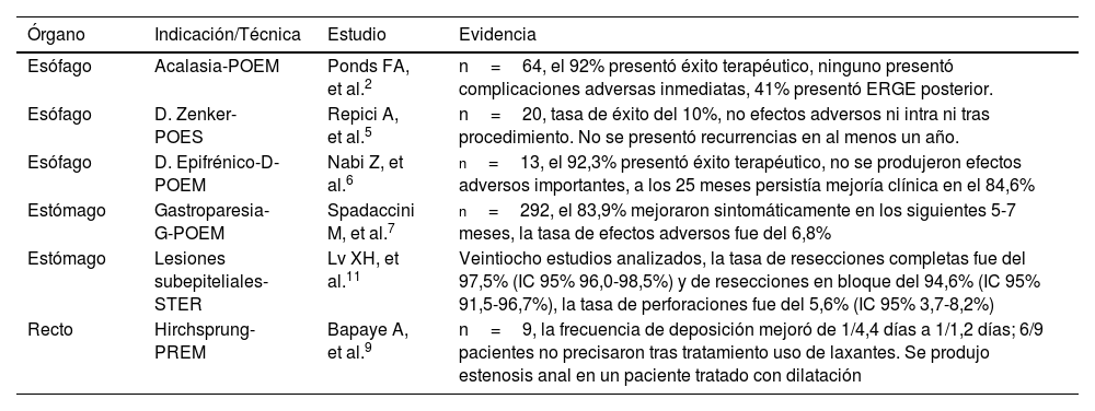 Tablas