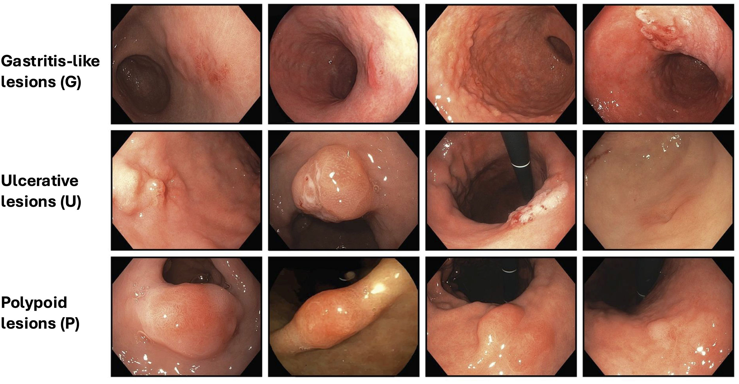 fig0005
