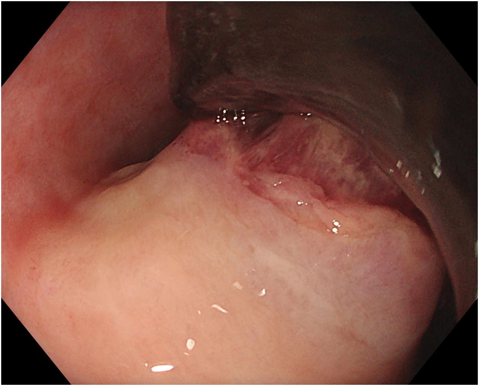 fig0005