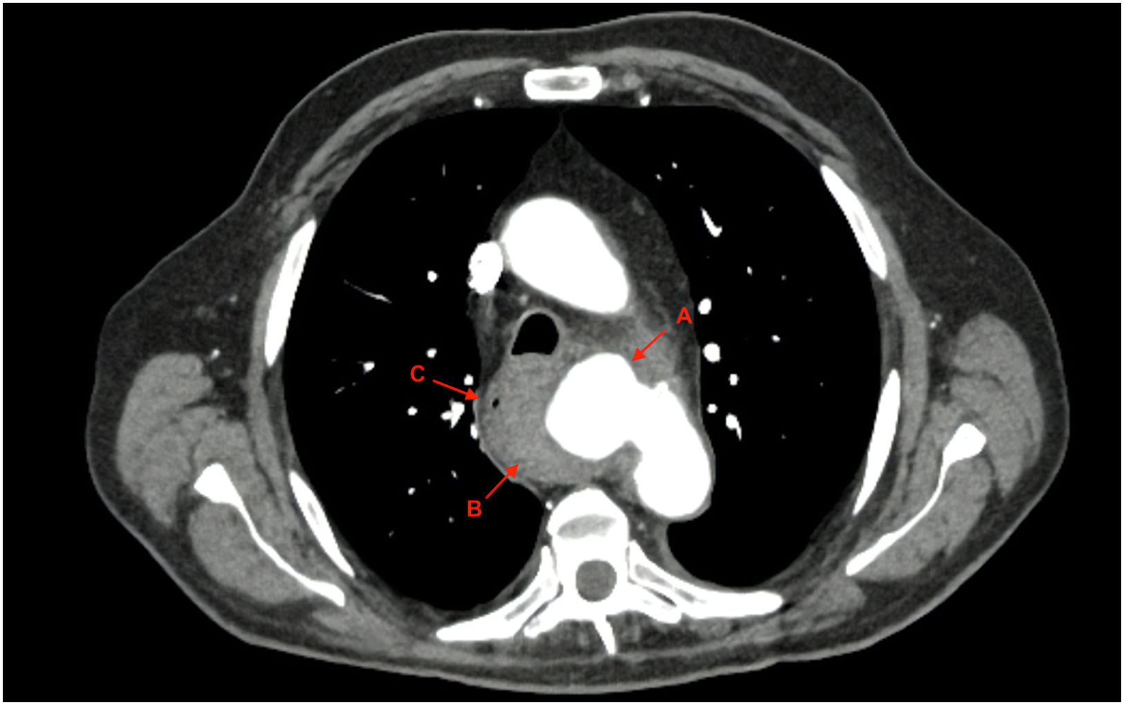fig0010