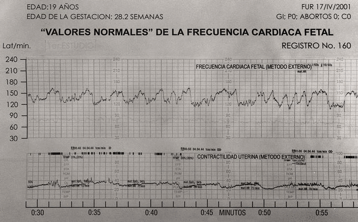 Tablas