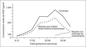 Valores del factor de crecimiento placentario (PlGF) en preeclampsia. Adaptada de Levine et al64.