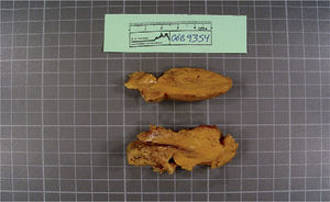 Foto macroscópica del hibernoma. Su forma es bien definida y regular, mide 6 cm y el color varía entre amarillo y marrón.