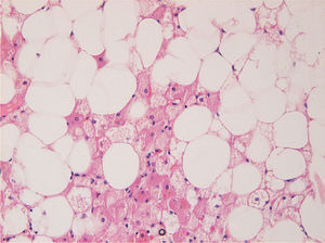 Se observan 3 tipos de células: redondas con gránulos eosinofílicos en el citoplasma, adipocitos grandes, redondeados y univacuolados y , por último, células multivacuoladas y granulares (HE, ×10).