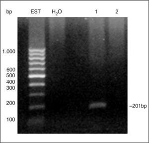 Electroforesis en gel de agarosa al 2%, teñido con bromuro de etidio de los productos de RT-PCR para mamaglobina A (MGA). H2O: control, calle 1 paciente positivo, y calle 3: donante sano. bp: pares de bases; EST: patrón de peso molecular.