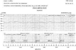 El trazo de la frecuencia cardíaca fetal muestra ondulaciones pequeñas, con patrón no reactivo. El producto nació deprimido.
