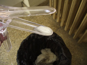 LEUCORREA LíQUIDA, en la valva del espéculo vaginal.