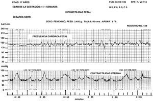 Pensamos que el incremento en la amplitud de las aceleraciones es un mecanismo compensador de la hipoxia crónica fetal. En el sistema circulatorio se produce vasodilatación, el oxígeno llega a los tejidos y órganos que lo requieren.