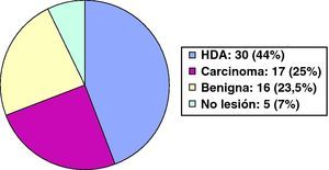 Resultados anatomopatológicos de la biopsia escisional de las pacientes diagnosticadas de hiperplasia ductal atípica en la biopsia percutánea. HDA: hiperplasia ductal atípica.