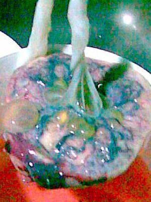 Imagen de la placenta.