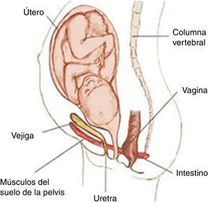El feto empuja hacia abajo la vejiga, la uretra y los músculos de la pelvis, causando la disfunción del SP. (El papel del fisioterapeuta en el embarazo y en la preparación al parto, María Pilar Cembro Linés, 2007).