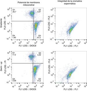 Citografías representativas de la evaluación del potencial de membrana mitocondrial (PMM) y de la integridad de la cromatina espermática mediante citometría de flujo. Espermatozoides seleccionados mediante swim-up o gradiente de densidad. Subpoblaciones para el PMM en las citografías: Q1 y Q2 (espermatozoides necróticos); Q3 (espermatozoides con PMM alto); Q4 (espermatozoides con PMM bajo). IFA: índice de fragmentación del ADN espermático.