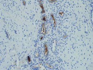 Corte histológico a 10 aumentos con tinción hematoxilina-eosina. Se visualiza la presencia de túbulos mesonéfricos con abundante estroma que los separa.