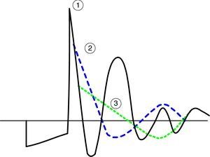 Patrón de onda SCENAR.
