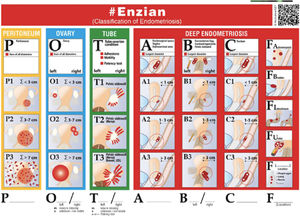 ENZIAN classification.