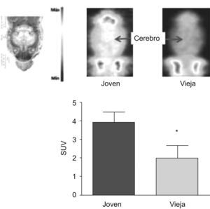 Consumo cerebral de glucosa in vivo en ratas jóvenes (4–7 meses) y viejas (22–24 meses). Imagen coronal del cerebro (intensidad expresada como «máxima captación por corte». Metabolismo cerebral de glucosa (18F-FDG) expresado como standarized uptake value (SUV). Valores expresados como media±SD (n=6). La diferencia estadística está expresada como *p<0,05 vs. control.