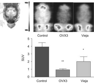 Consumo cerebral de glucosa in vivo en ratas jóvenes (4–7 meses), OVX 3 y viejas (22–24 meses). Imagen coronal del cerebro (intensidad expresada como «máxima captación por corte»). Metabolismo cerebral de glucosa (18F-FDG) expresado como standarized uptake value (SUV). Valores expresados como media±SD (n=6). La diferencia estadística está expresada como **p<0,01; *p<0,05 vs. control.