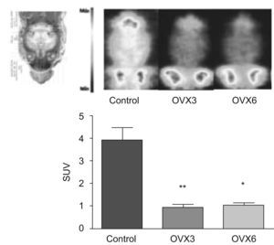 Consumo cerebral de glucosa in vivo en ratas jóvenes (4–7 meses), ovariectomizadas durante 3 y 6 semanas (OVX 3 y OVX 6). Imagen coronal del cerebro (intensidad expresada como «máxima captación por corte»). Metabolismo cerebral de glucosa (18F-FDG) expresado como standarized uptake value. Valores expresados como media±SD (n=6). La diferencia estadística está expresada como **p<0,01; *p<0,05 vs. control.