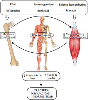 Fisiopatología de la osteosarcopenia. Adaptada de Kawao et al.30.