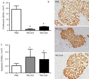 Proliferación (a) (b) y apoptosis (c) de las células β. Se representa la media ± DE. Las flechas (b) muestran los núcleos BrdU positivos para cada uno de los tratamientos. a: TAC-d12 vs PBS p = 0,009. b: TAC-CsA vs PBS p = 0,001 y vs TAC-d12 p = 0,003. c: TAC-d12 vs PBS p = 0,172. d: TAC-CsA vs PBS p = 0,311 y vs TAC-d12 p = 0,824.